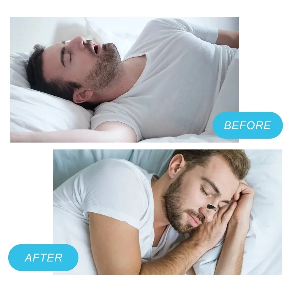 Nose Strips Increase Sports Air Intake Improve Sleeping - Image 4